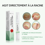 Charger l'image dans la galerie, OnglePur™ - Stylo Anti-Mycose Express Ta solution discrète pour des ongles sains en 21 jours
