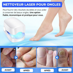Charger l'image dans la galerie, Laser Ongles Pro™- traitement définitif des mycoses

